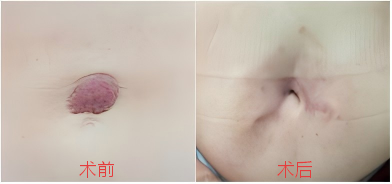 3532f057ea4be69d6ac0774f8d614cbd.png
